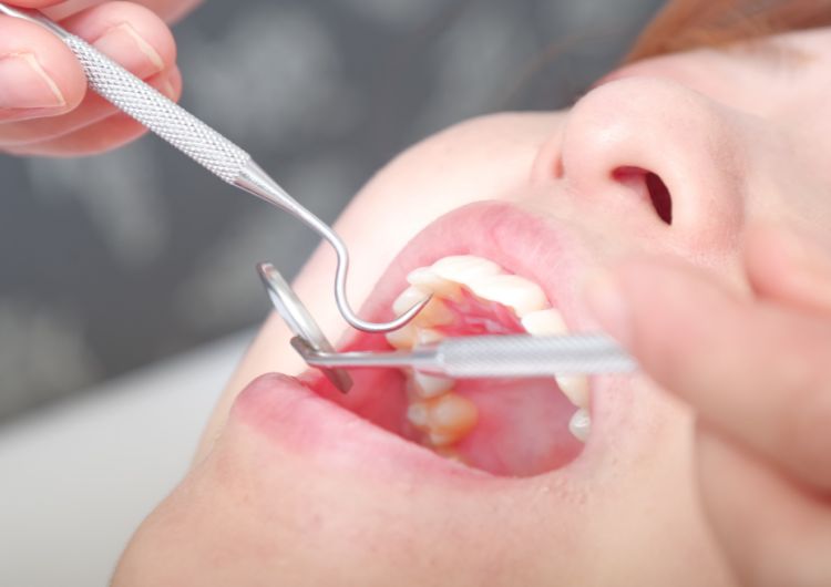 歯科治療している