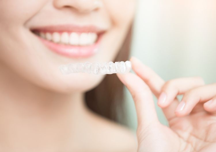 インビザライン