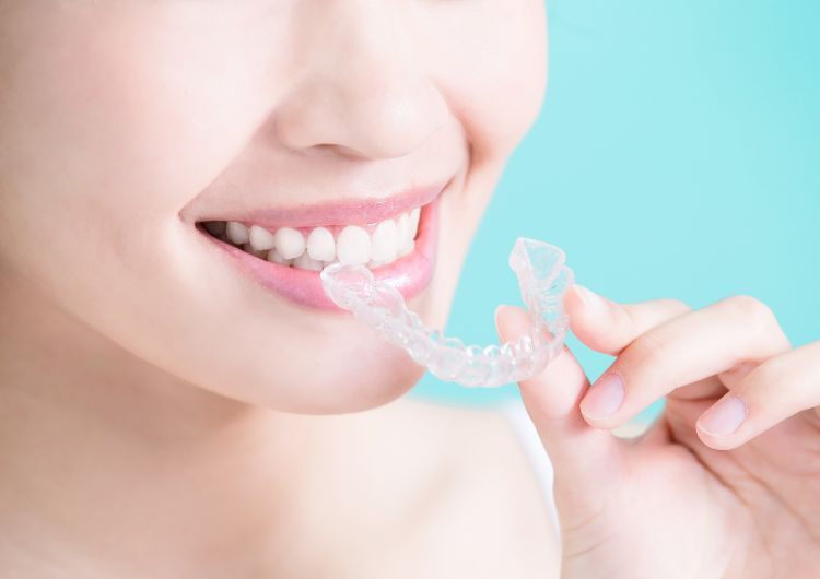 マウスピースをつけようとする女性の口元