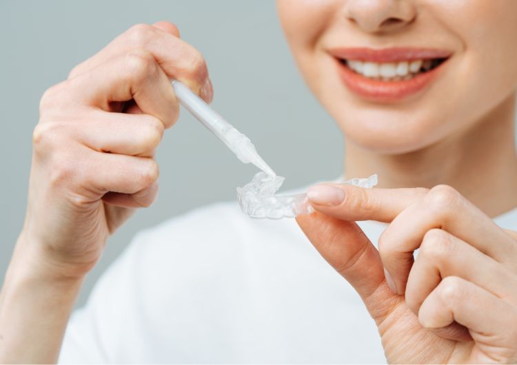 歯のホワイトニング用マウスピース